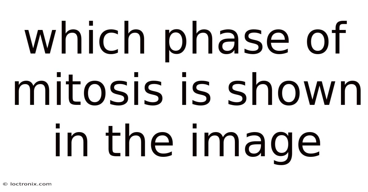 Which Phase Of Mitosis Is Shown In The Image